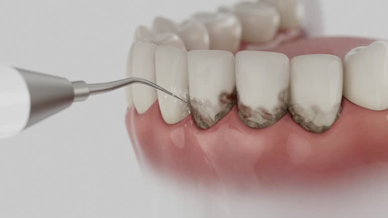 Reliable Dental Implants contractor in Marietta, PA by Smile Center Dentistry